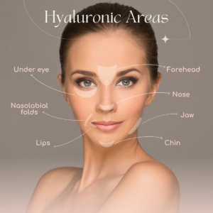 benefits of dermal filler
